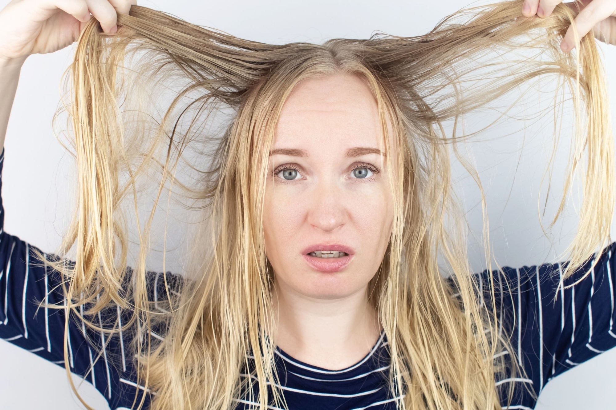 Women with oily greasy scalp & roots and dry damaged hair.