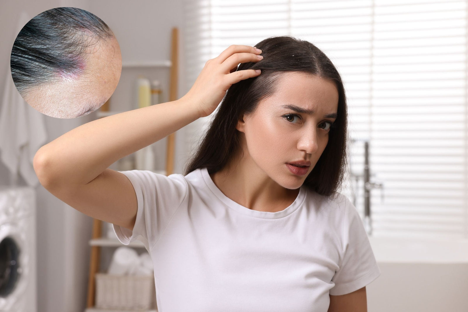 Woman with Scalp Psoriasis in Bathroom